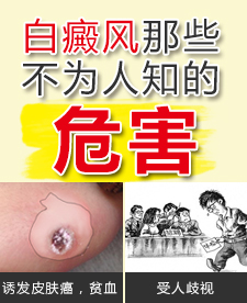 面部白癜风对患者会造成哪些危害